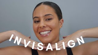 MY INVISALIGN EXPERIENCE [upl. by Aleibarg]