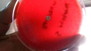 Bacitracin test for Streptococcus pyogenes [upl. by Burkitt424]