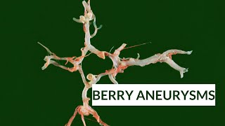 Berry Aneurysms  Circle of Willis  Blood supply of Brain [upl. by Annor533]