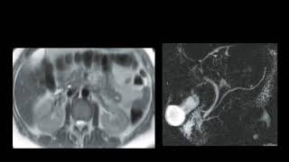 Radiology teaching points 39 Amr Saadawy [upl. by Llerdnad]