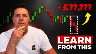 What my biggest trading losses taught me [upl. by Nahk782]