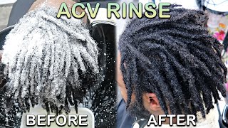 My First ACV RINSE on DREADLOCKS  How To WASH LOCS Starter Locs Journey [upl. by Hsirt]