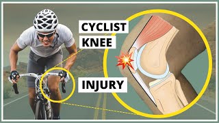 Prepatellar fascia injury also known as Cyclists knee explanation diagnosis and treatment [upl. by Delanty]