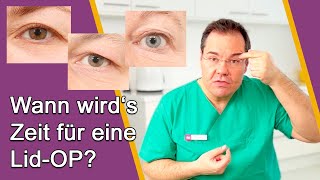 AugenlidOP – Ab wann ist OP sinnvoll Gibt es Alternativen ohne OP Dr Günther Düsseldorf [upl. by Hurst]