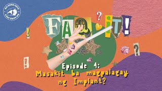 Masakit ba magpalagay ng Implant  FAQ It [upl. by Kcir716]