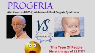 progeria  दुर्लभ बिमारी ।। अमिताभ बच्चन को थी ये बिमारी ।। बहुत जरूरी जानकारी [upl. by Aihsemek]