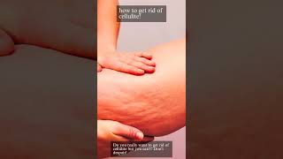 How To Get Rid Of Cellulite cellulitis skincare [upl. by Sopher]