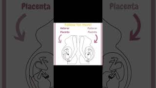 Why Your Placenta Location Matters [upl. by Nnyletak984]