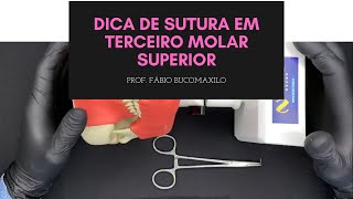 DICA DE SUTURA PARA TERCEIROS MOLARES SUPERIORES [upl. by Ladnik]