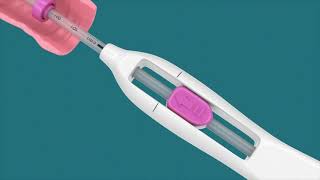 IUD Insertion Video [upl. by Aisek982]