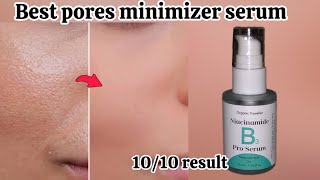 Organic traveller Niacinamide B3 pro serum detailed amp honest review 100 percent results [upl. by Pasquale468]