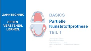 Partielle Kunststoffprothese  Teil 1 [upl. by Nerraj]