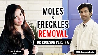 Flat Moles Raised Moles on the Face Removal  Creams  No Home Remedies  Dermatologist Dr Rickson [upl. by Neved758]