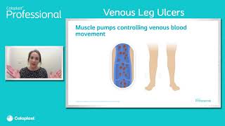 Coloplast Wound Care Venus Leg Ulcer [upl. by Enyrb367]