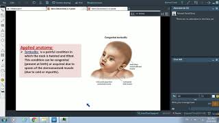 Posterior Triangle of Neck amp Sternomastoid Muscle  Dr Ahmed Farid [upl. by Aneehsit]