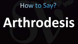 How to Pronounce Arthrodesis Correctly [upl. by Loleta]