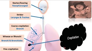 Respiratory System Examination in Newborn I Newborn Examination PART 6  Pediatrics [upl. by Eikceb99]