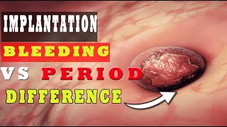 Recognizing Implantation Symptoms  MUST WATCH [upl. by Alohcin]