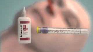 Medical Tube Sengstaken Blakemore tube Insertion Video [upl. by Allina]