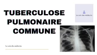 TUBERCULOSE PULMONAIRE COMMUNE [upl. by Thais]