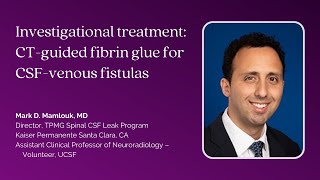 Dr Mark Mamlouk—Investigational treatment CTfibrin glue for CSFvenous fistulas [upl. by Katie483]