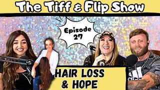 Ep 27  Hair loss amp Hope [upl. by Lemire]