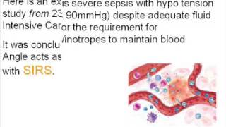 Systemic Inflammatory Response Syndrome SIRS Prognosis [upl. by Eshelman]