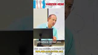 Varicose veins drnajeeb shortvideo drnajeeblectures [upl. by Aicenav]