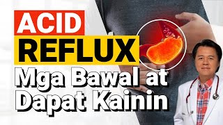 Acid Reflux Mga Bawal at Dapat Kainin  By Doc Willie Ong Internist and Cardiologist [upl. by Lyrrehs]