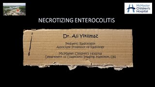 Necrotizing Enterocolitis [upl. by Alon]