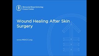 Wound Healing After Skin Surgery  Memorial Sloan Kettering [upl. by Stephie]