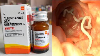 Albendazole oral suspension  Zentel oral Suspension  Pet me keeday  चुन्ना की समस्या की दवाई [upl. by Oizirbaf95]