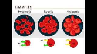 ACHSedu HypertonicHypotonic by Dr Jerry Cronin [upl. by Shorter]