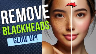 How To Treat Blackheads Naturally  How To Fix Blackheads [upl. by Trebreh454]