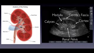 Introduction to Renal Ultrasound [upl. by Attenal744]