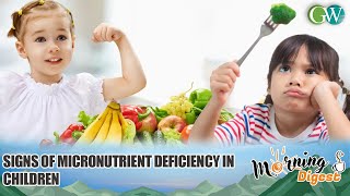 SIGNS OF MICRONUTRIENT DEFICIENCY IN CHILDREN [upl. by Vedi]