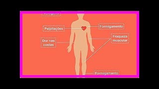 Symptome Ursachen und Behandlung von GuillainBarréSyndrom [upl. by Barnet]