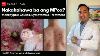 Nakakahawa ba ng Mpox Monkeypox Causes risk factors symptoms treatment and prevention [upl. by Ayifa]