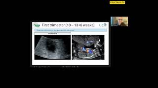 Basic Ultrasound by Dr Diane Lambo Consultant Maternal Fetal Medicine Obstetrics UK [upl. by Forsyth]