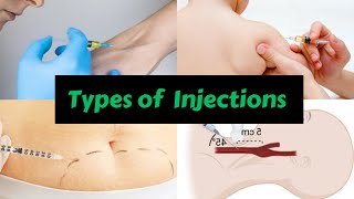 Types of Injections nursing mbbs medical injection intramuscularinjection intravenousinjection [upl. by Suinotna]