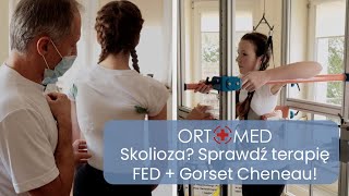 Leczenie skoliozy metodą FED z Gorsetem Cheneau  BIO Mariusz Czarnecki OrtoMed Bytom [upl. by Llemor]