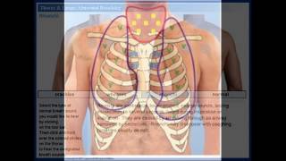 normal tracheal sound [upl. by Krahmer]