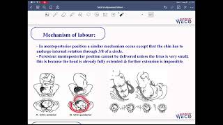 Obstetrics Fetal malpresentation 2 [upl. by Pearlstein]