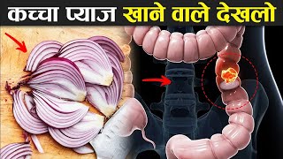 कच्चा प्याज़ खाते हो तो एक बार जरूर देखना  Health Benefits And Side Effects Of Onion [upl. by Adoree107]