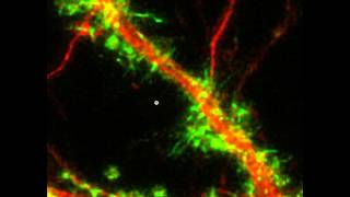 Local collapse and regrowth of dendritic Factin following glutamate [upl. by Alrzc]