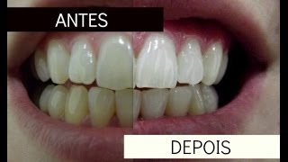 Clareamento dental com produto Oral B [upl. by Caruso]