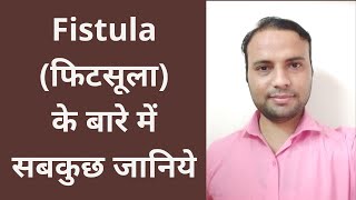 फीटसूला के बारे में सबकुछ जानिये  Everything about Fistula [upl. by Buhler]