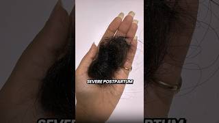 The Hair Growth Serum That Grew My Hair back hairgrowth hairfall hairfallsolution wishcare [upl. by Hoashis]