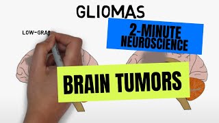 2Minute Neuroscience Brain tumors [upl. by Ardekal]