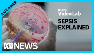 Sepsis explained Why the exact causes of this lifethreatening condition are a mystery  ABC News [upl. by Enoed330]